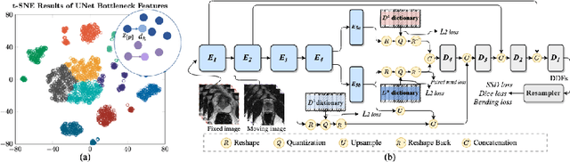 Figure 1 for Collaborative Quantization Embeddings for Intra-Subject Prostate MR Image Registration