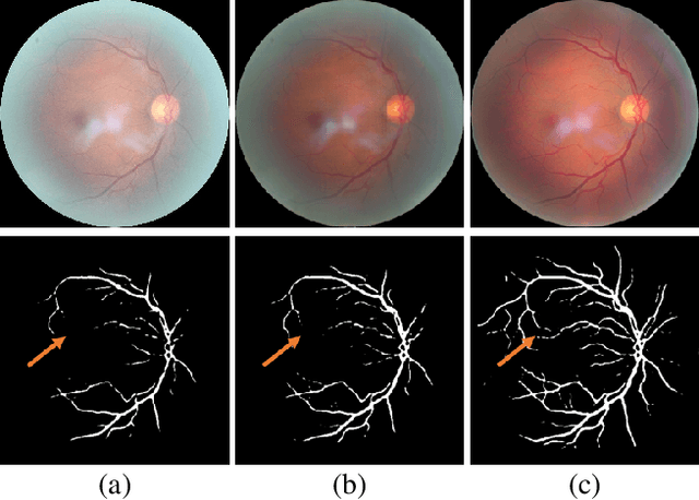Figure 1 for Understanding and Correcting Low-quality Retinal Fundus Images for Clinical Analysis