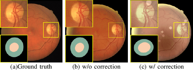 Figure 3 for Understanding and Correcting Low-quality Retinal Fundus Images for Clinical Analysis