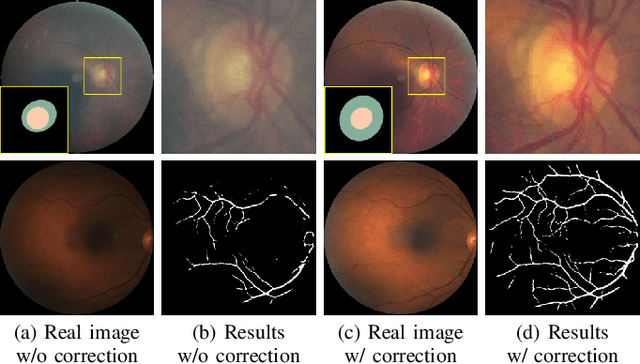 Figure 4 for Understanding and Correcting Low-quality Retinal Fundus Images for Clinical Analysis