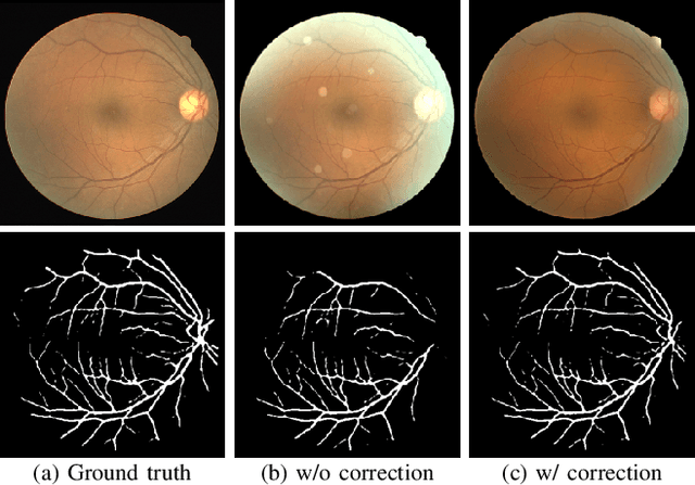 Figure 2 for Understanding and Correcting Low-quality Retinal Fundus Images for Clinical Analysis