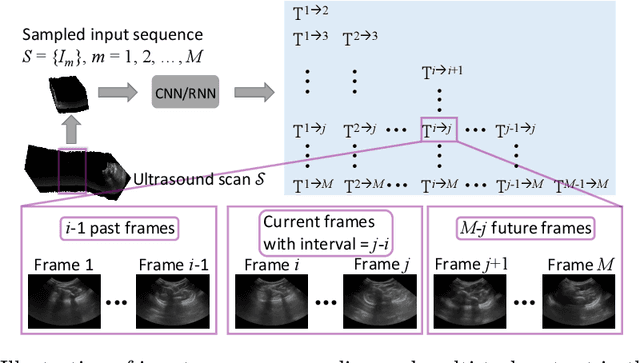 Figure 1 for Trackerless freehand ultrasound with sequence modelling and auxiliary transformation over past and future frames