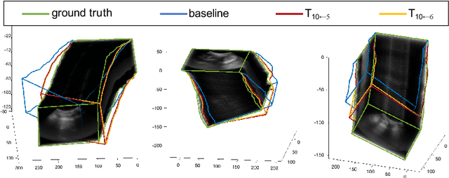 Figure 3 for Trackerless freehand ultrasound with sequence modelling and auxiliary transformation over past and future frames