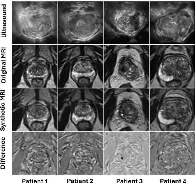 Figure 3 for Do High-Performance Image-to-Image Translation Networks Enable the Discovery of Radiomic Features? Application to MRI Synthesis from Ultrasound in Prostate Cancer